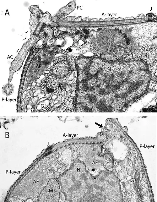 EM-Aufnahmen von Zilienhaaren und Kortex (P-Layer) von Lateronema sp. [Telonema antarcticum]