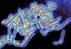 Abb. 2: Kolorierte EM-Aufnahme von Virionen des Marburg-Virus