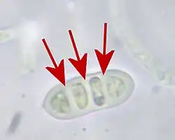 Querseptierte Spore der Zerfließenden Gallertträne (Dacrymyces stillatus)