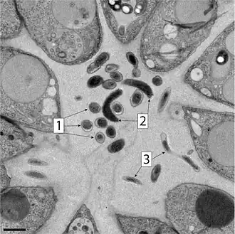 Verschiedene Morphologien (1–3) der bakteriellen Symbionten in B. monosierra (TEM-Aufnahme, Balken: 1&nbsp;µm).