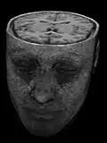 3D-Rekonstruktion (Volumenrendering) eines MRT-Datensatzes