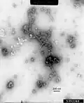 Virionen von Carnation latent virus (CLV)