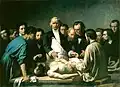 Leçon d’anatomie du docteur Velpeau