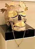 Römischer Goldschmuck