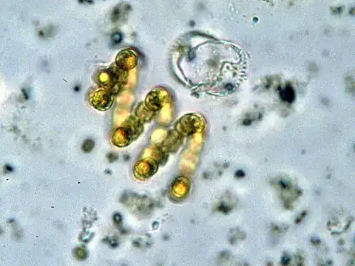 Anabaena spiroides