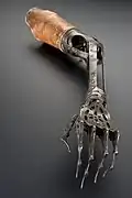 Arm- und Handprothese aus dem 19.&nbsp;Jahrhundert