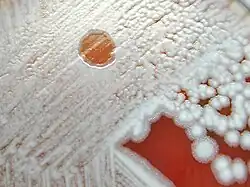 Lysehof von Bacillus-Phage Gamma bei Bacillus anthracis, rechts unbefallene Einzelkolonie