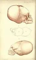 Lithographie von James Basire: (1842) Schädel von Kleinkindern die als Titicacatianer klassifiziert wurden; veröffentlicht im Journal of Natural History.[75]