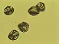 Betula Pollen 400x