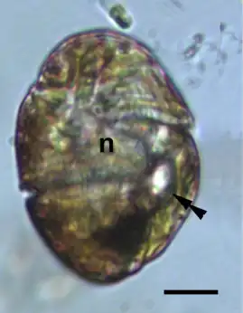 Lichtmikroskop-Aufnahme einer Zelle, durchscheinend braun, mit heller gefärbtem Zellkern in der Mitte und Ocelloid, bestehend aus einem hellen Bereich (Hyalosom, d.&nbsp;h. Linse) neben einem dunklen Bereich (Netzhautkörper).