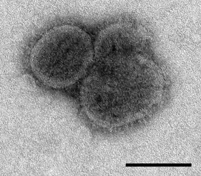 Drei Virionen des Bourbon-Virus in der sphärischen Form