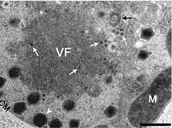 CroV repliziert in einer Virusfabrik (VF). Die weiße Pfeilspitze zeigt neu gebildete CroV-Partikel an. Es liegt eine Koinfektion mit dem Virophagen Mavirus vor, die weißen langstieligen Pfeile zeigen dessen kleine Partikel an.