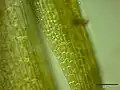 basale Laminazellen(links), Laminazellen in der Mitte des Blattes (rechts), 400-fach vergrößert