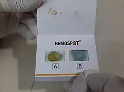 Foto eines Teststreifens