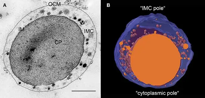 Ultrastruktur von I.&nbsp;hospitalis (Bild mit Anmerkungen)