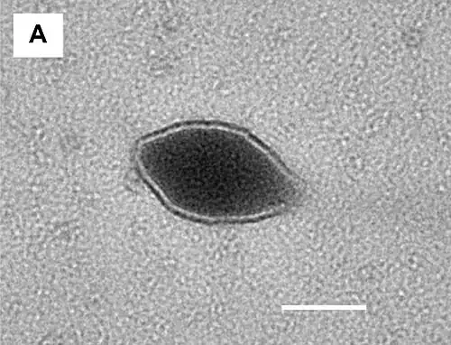 „Sulfolobus tailed spindle-shaped virus 3“ (STSV3), TEM-Aufnahme