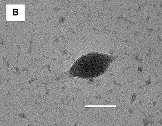 „Sulfolobus tailed spindle-shaped virus 4“ (STSV4), TEM-Aufnahme