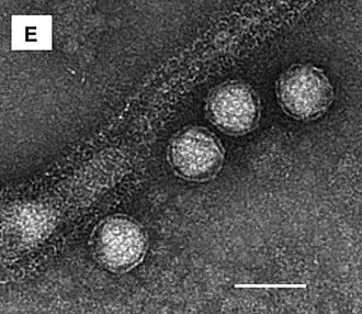 „Sulfolobus polyhedral virus 3“ (SPV3) alias „Sulfolobus turreted icosahedral virus 3“ (STIV3), TEM-Aufnahme