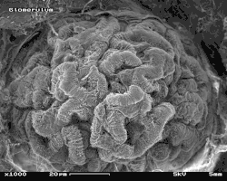 Glomerulus im Rasterelektronenmikroskop (REM) Bildbreite ca. 115&nbsp;µm