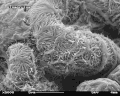 Glomerulus im REM Bildbreite ca. 22,8&nbsp;µm