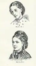 Darstellung von Miss A vor (oben) und nach der Behandlung (unten)[6]