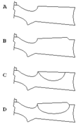 Verschiedene Kolbenformen