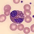 Eosinophiler Granulozyt