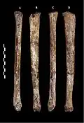 Schienbein U.W. 101-484 in vier Ansichten