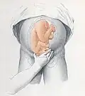 3. Leopold-Handgriff: Bestimmung des vorangehenden Teils[1]