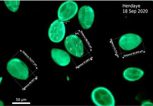 Epifluoreszenzmikroskopie-Aufnahme einer Probe von Hendaye (September 2020).