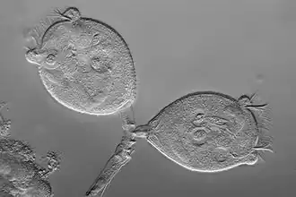 Vorticella sp. (Peritrichia)