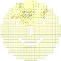 Online, nicht rechteckig