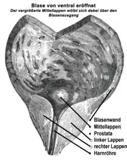 Schnittbild der Prostata