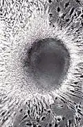 Gleiche Zellkultur nach Expression des großen T-Antigens von SV40: Maligne Transformation mit Fokus