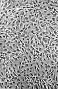 Normale NIH-3T3-Zellen in einer Zellkultur, Phasenkontrastmikroskop 100× Vergrößerung
