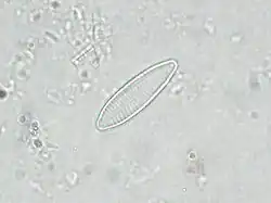 Nitzschia paleacea