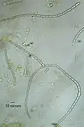 Nostoc azollae, Zellfäden