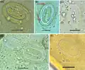 Physaloptera-Eier, gefunden in einem bronzezeitlichen Grab im heutigen Iran