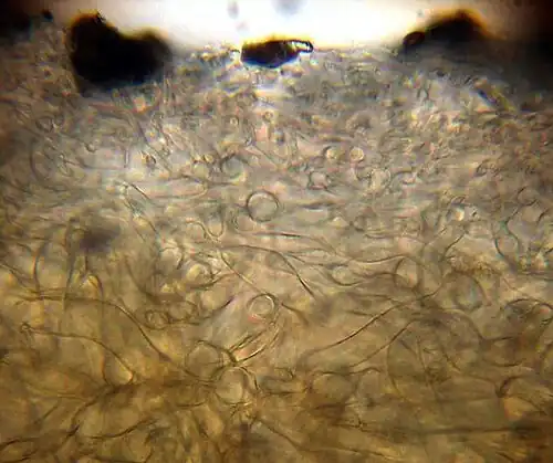 Cuticula des Hutes