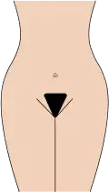 Bikini Lines