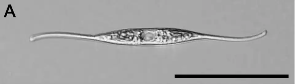 LM-Ansicht von N. reversa, Stamm KT30. Balken: 50&nbsp;μm.