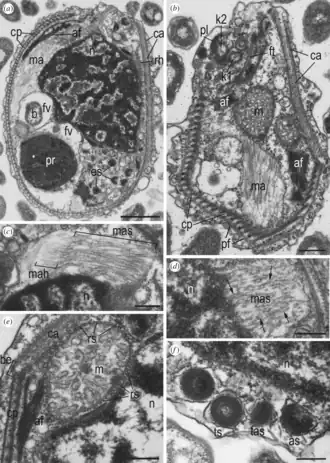 Allg. Zellorgansation von A. versatilis (a,b,d,e) & A. idiomastiga (c,f). Balken: (a) 1 µm, (b) 400 nm, (c–f) 200 nm.