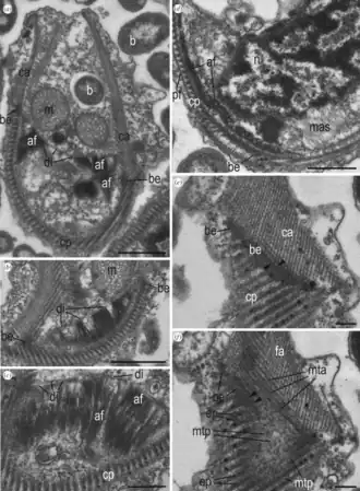 Struktur des Gürtelbereichs und des Diaphragmas von A.&nbsp;idiomastiga (a–c) & A.&nbsp;versatilis (d–f). Balken: (a,b,d) 1&nbsp;µm; (c) 500&nbsp;nm; (e,f) 250&nbsp;nm.[A. 4]