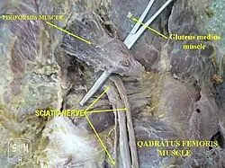 Präparat: Der N. ischiadicus verläuft unterhalb des M. piriformis durch Foramen infrapiriforme.