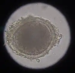 Toxocara-Ei