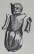 Thomas Bartholins Zeichnung