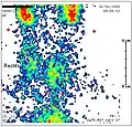 Schilddrüsenszintigrafie bei Subakuter Thyreoiditis: verminderter Uptake.