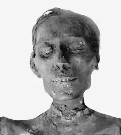 Kopf der Mumie von Thutmosis IV., Ägyptisches Museum Kairo (CG 61073)