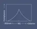 I. Normales Tympanogramm, Maximum bei 0 Pa.
