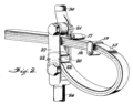 Zeichnung aus US-Patent US1101435